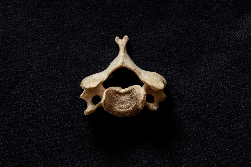Causas del dolor cervical. Ejercicios y prácticas para evitarlo
