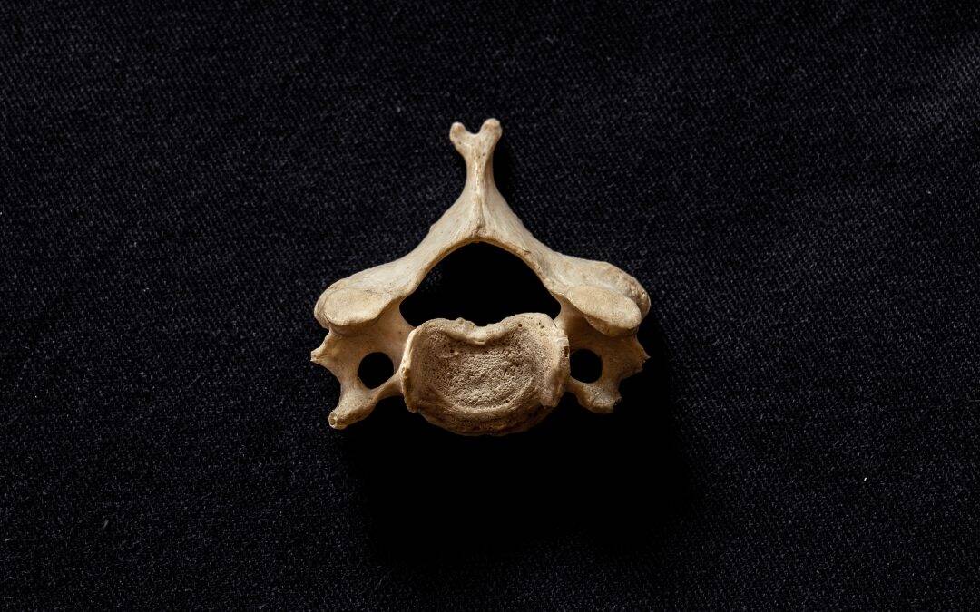 Causas del dolor cervical. Ejercicios y prácticas para evitarlo