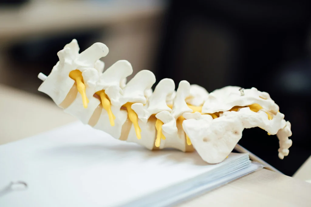 Hernia discal sin cirugía: qué debes saber antes de operarte