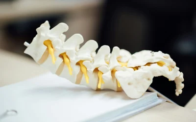 Hernia discal sin cirugía: qué debes saber antes de operarte